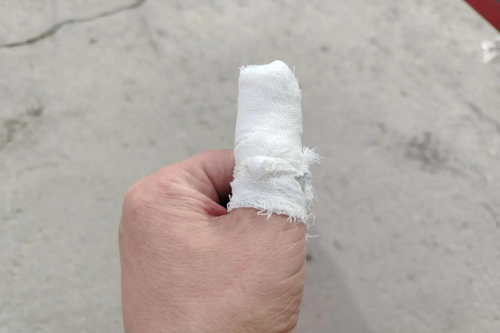 Фото В Новосибирске вор-рецидивист при задержании прокусил палец сотруднику охранного агентства до кости 3